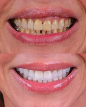 Slider image (9) Best Dental Clinic in Istanbul - Niva Aesthetic